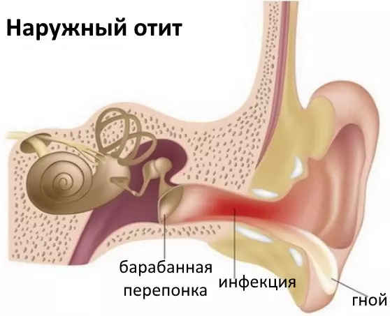 Чем лечить корку в ушах — изображение 17