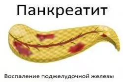Свекла не переваривается причины — изображение 3
