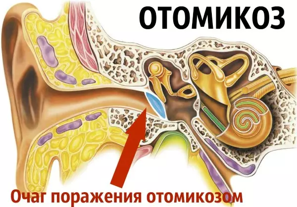 Чем лечить корку в ушах — изображение 13