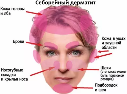 Чем лечить корку в ушах — изображение 20