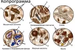 Свекла не переваривается причины — изображение 5